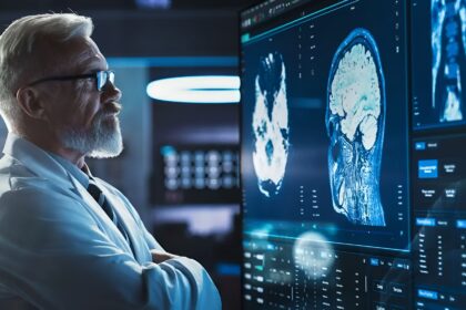 Alzheimer-disease-new discovery-scientists-Dementia