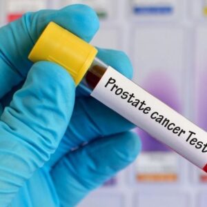 Prostate cancer in India