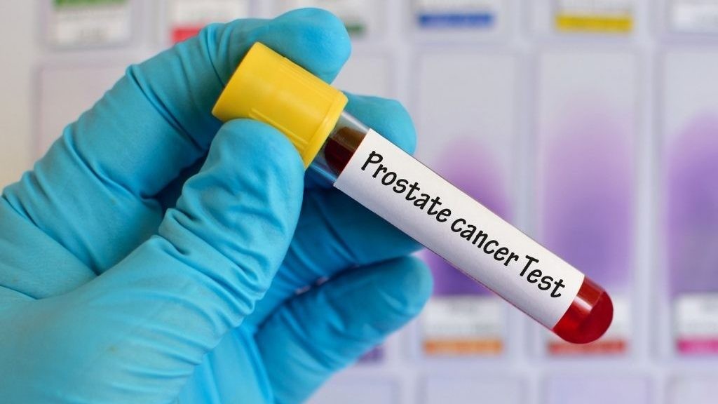Prostate cancer in India